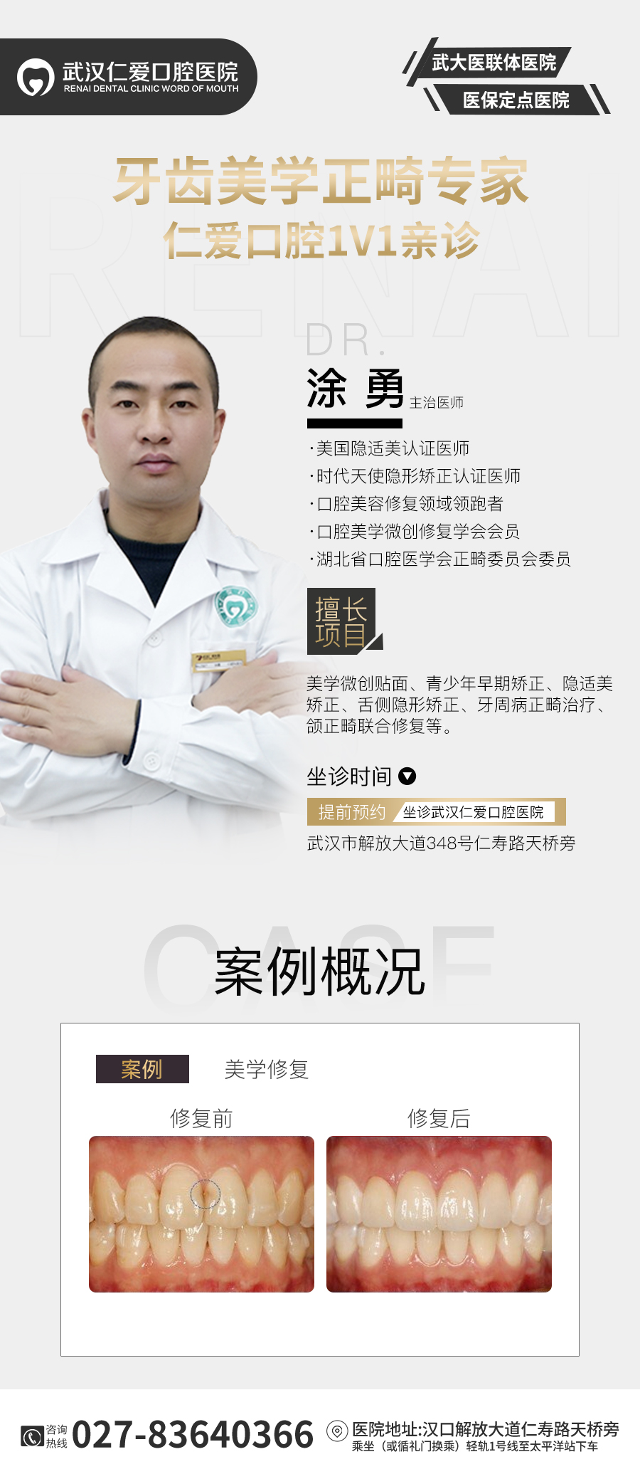 武汉仁爱口腔案例 ▏“微创瓷贴面”和牙缝说拜拜