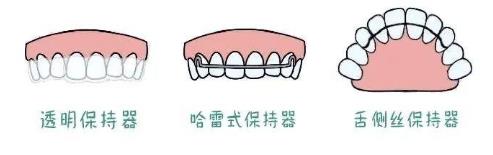 为什么正畸结束了,一定要戴保持器——全民矫牙公益行动