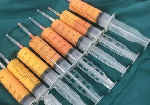 艾玛整形白馨月:吸脂术前要了解哪些问题?