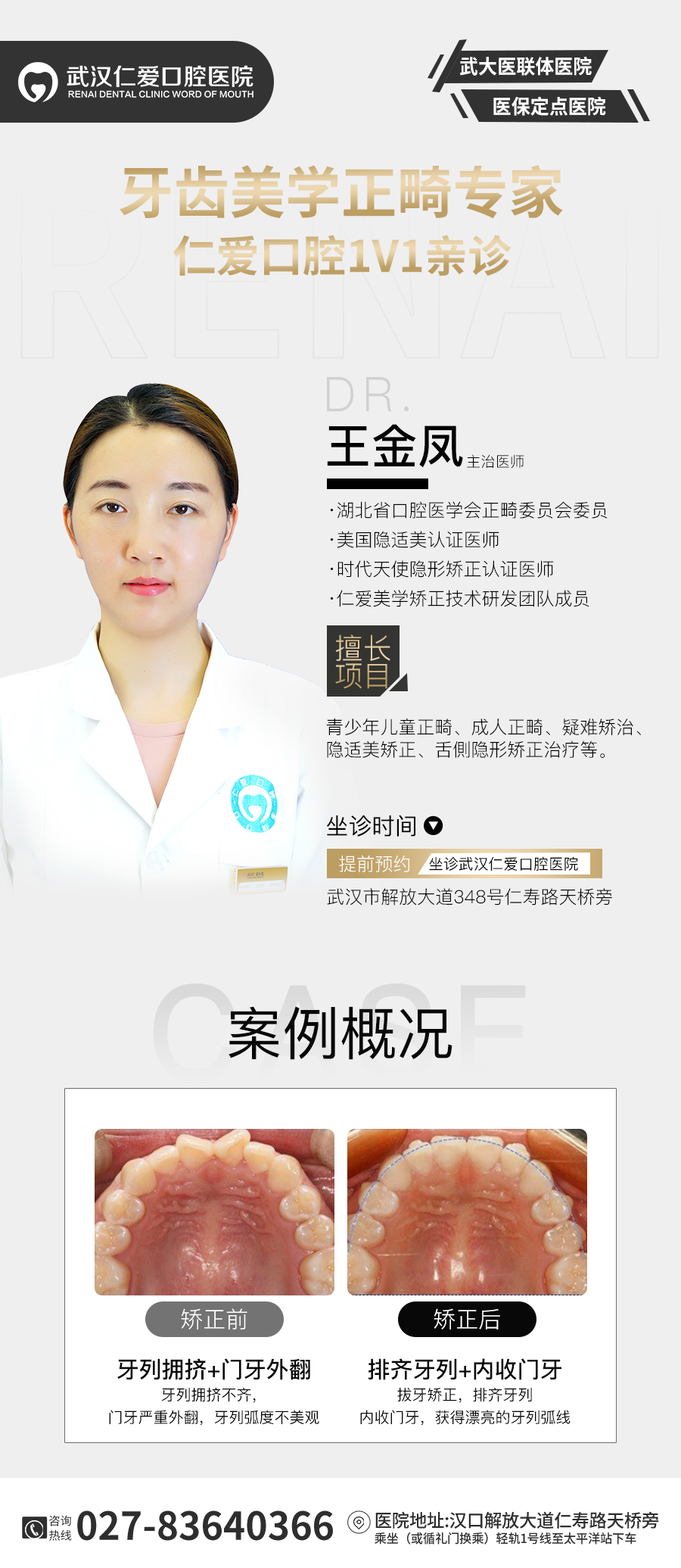 武汉仁爱口腔牙齿矫正案例丨深覆合+深覆盖+下巴后缩,不拔牙实现侧颜逆袭