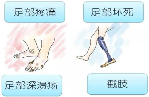 山东治疗糖尿病足优质推荐医院