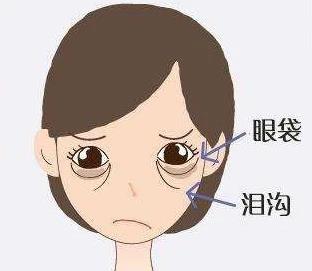 不开刀祛眼袋:早睡能把眼袋睡没吗?答案很意外!