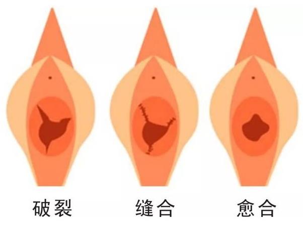 重庆军科私密整形医院,处女膜修复安不安全?