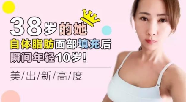 沈阳杏林整形医院自体脂肪填充案例