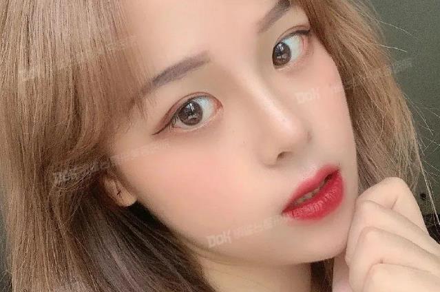 云南铜雀台整形医院赵兰明隆鼻好不好 汇集多年东方美鼻精华