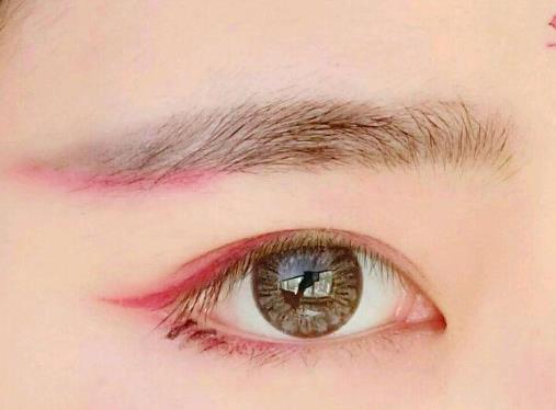 泪道堵塞的症状是什么?泪道堵塞怎么办