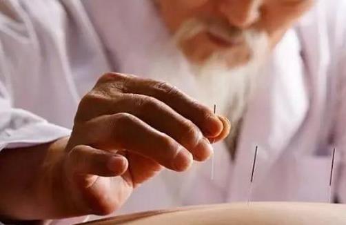 针灸有什么副作用?中医针灸有哪些作用?