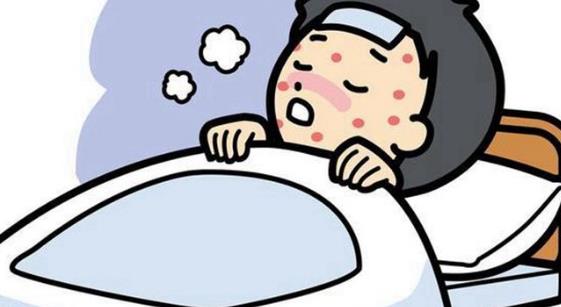 患了麻疹有哪些症状?哪些人容易患麻疹?