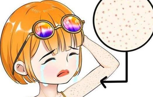鸡皮的典型症状是什么?护理鸡皮肤的注意事项有哪些?