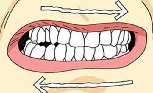 磨牙症有哪些疾病分类?引起磨牙症的原因有哪些?