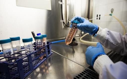血性腹水需要注意什么?血性腹水做哪些检查?