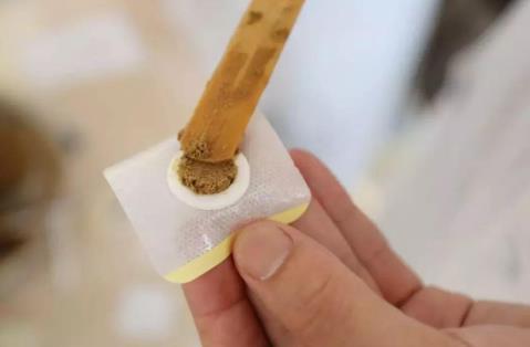 三伏贴的配方有哪些?三伏贴去湿气贴敷位置