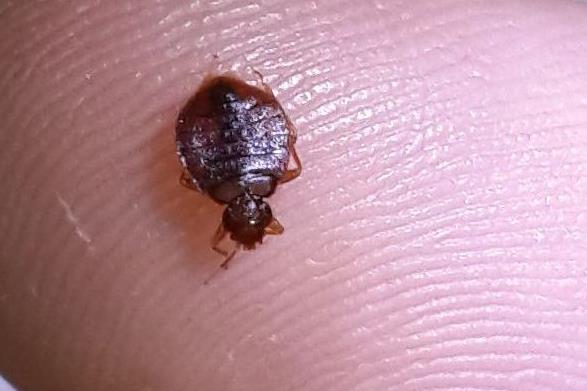 头上有虱子怎么去除掉?虱子是怎么长出来的?虱子和跳蚤区别