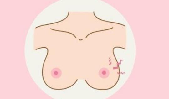 乳头湿疹有哪些症状?为什么会患乳头湿疹?