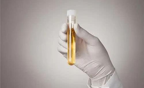 引起蛋白尿的原因有哪些?蛋白尿的类型有哪些?