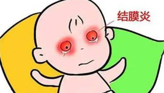 结膜炎有哪些治疗方法?患结膜炎需要注意什么?