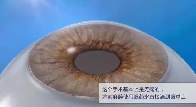 上海眼科专家化身主播,中秋佳节陪老人家共话白内障、老花那些事