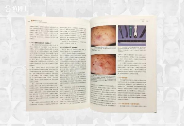 博士说痘||除痘根之逼进痘痘老巢的清剿 ——细说细胞祛痘之五