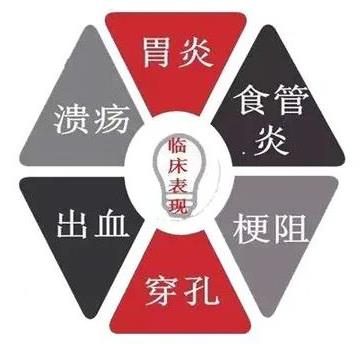 成都西部痛风风湿医院:非甾体抗炎药在类风湿关节炎用药中扮演着怎样的角色